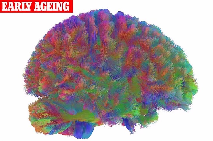 раннє старіння мозок