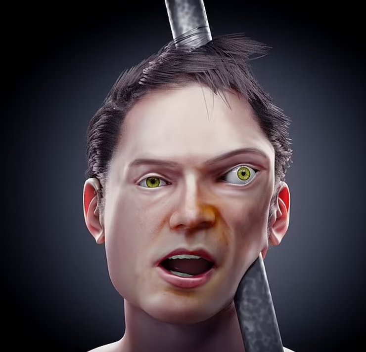 Финеас Гейдж