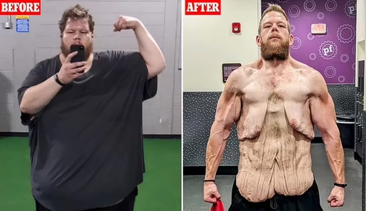 Чоловік, зайва вага, схуднення, спортзал,