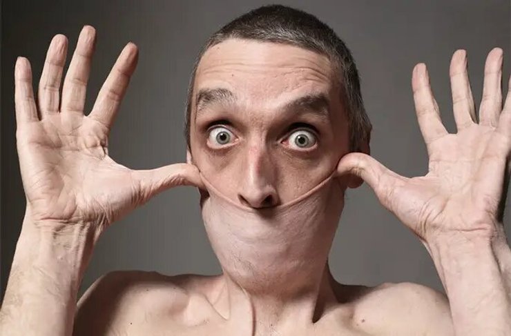 Гарри шутит, что может с легкостью убрать второй подбородок