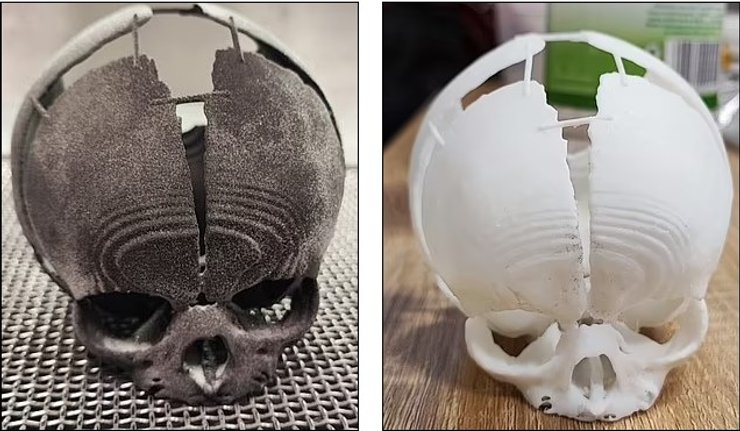 череп 3D печать