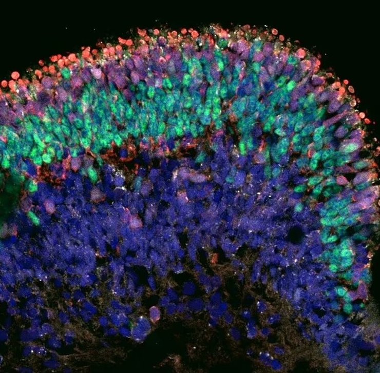 клетки глаза