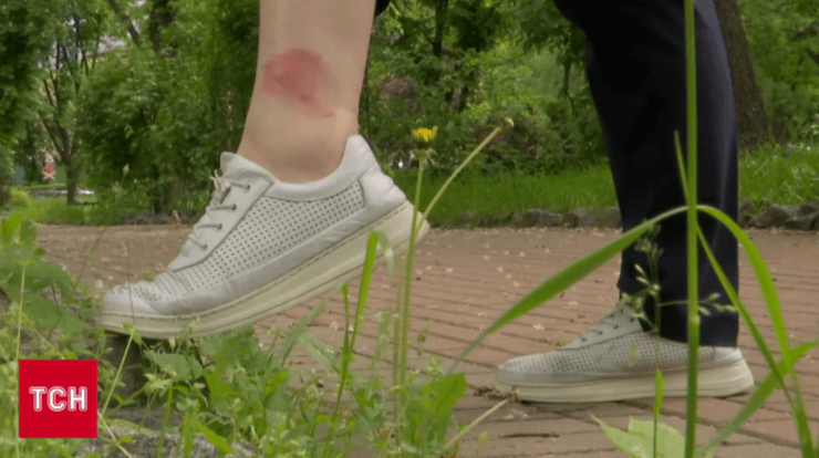 Мошки, комахи, Київ, столиця, алергія, загроза, укуси комах