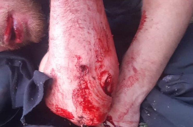 автобус, нападение, обстрел, активисты, Харьков, трасса, Илья Кива, Патриоты за жизнь