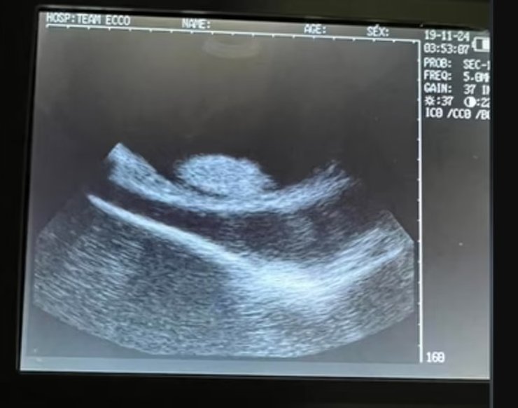 скат шарлотта узи