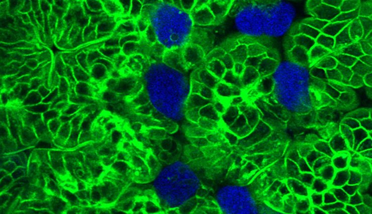 амеба, паразит, E. histolytica