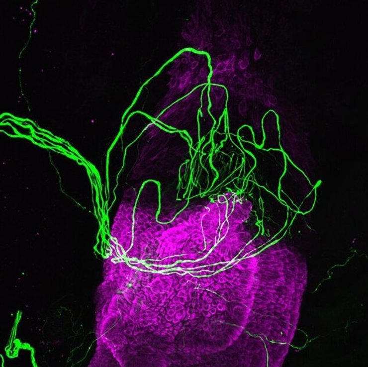 сенсорные нервы волосы