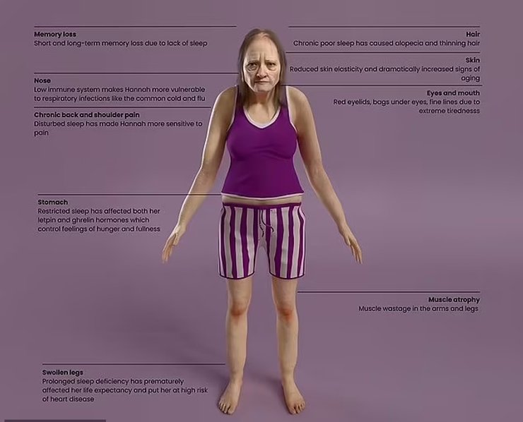 сон, недостаток сна, последствия недостатка сна