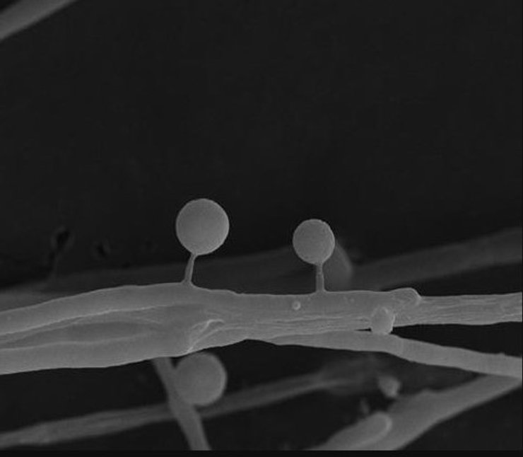 токсоциста