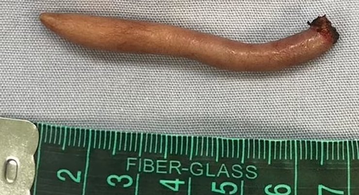 хвіст, людський хвіст