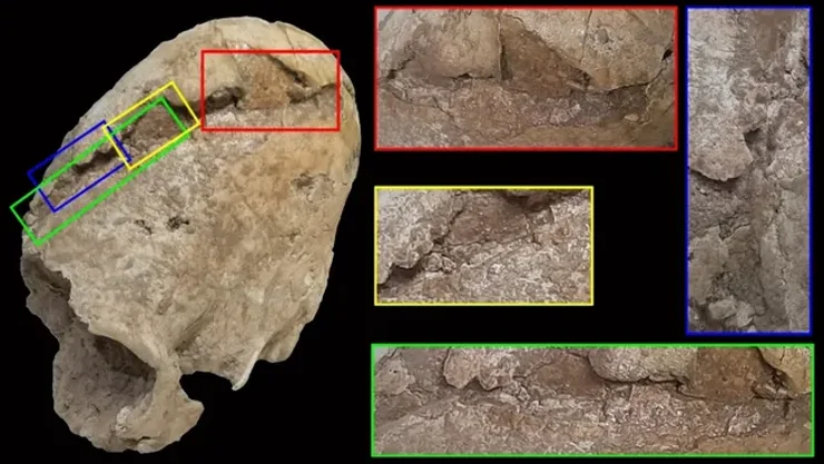 череп молодой женщины