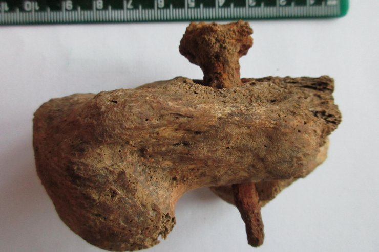 пяточная кость, гвоздь, фото