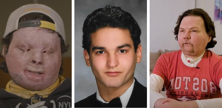 Пересадка лица, Джо ДиМео из США, реакция собак, курьезы, хирургическое вмешательство, аномалии, интересные истории, видео