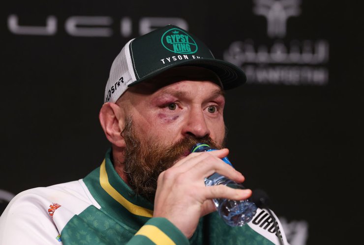 Тайсон Фьюри, Фьюри