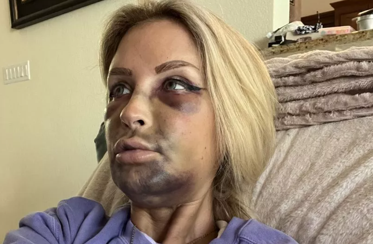 Джессика Макко из Сан-Антонио, стоматология, лечение зубов, импланты, курьезы, США, приколы