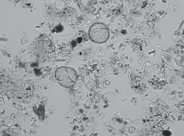 Пыльца, микроскоп