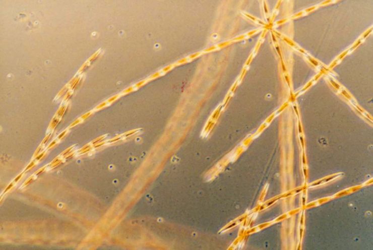 нейротоксин, водорості, домашня кислота