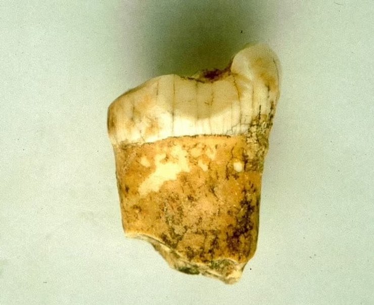 зуб неандертальця