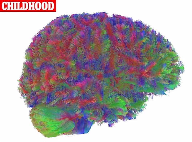 дитинство мозок