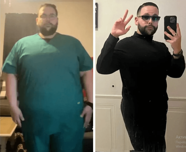 Карлос Ривера: до и после