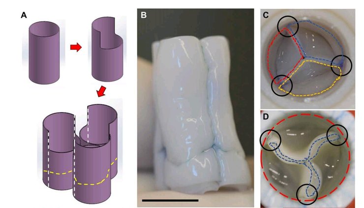 Схема сборки искусственного клапана из трех трубок (А). Клапан нового дизайна (С) и старого, "трубка-в-трубке" (D). Штрихами обозначены отдельные трубки, черным обведены швы на месте соединения трубок.