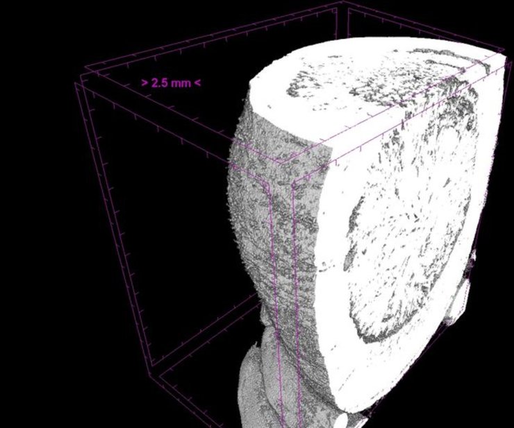желчный пузырь