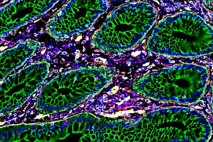 кишечник человека