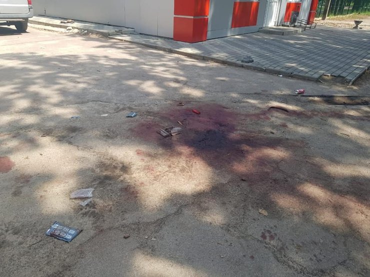 житомир, нож, нападение