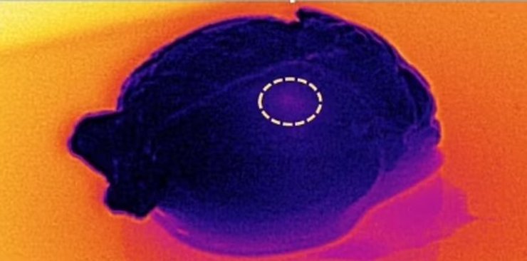 имплантат, мозговой имплант