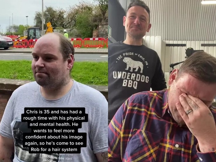 Чоловік розридався через зачіску, лисіючий чоловік, лисина, облисів на маківці, втратив волосся, повернули волосся, зачіска