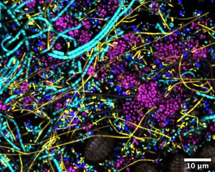 микробы, бактерии, вирусы, цианобактерии