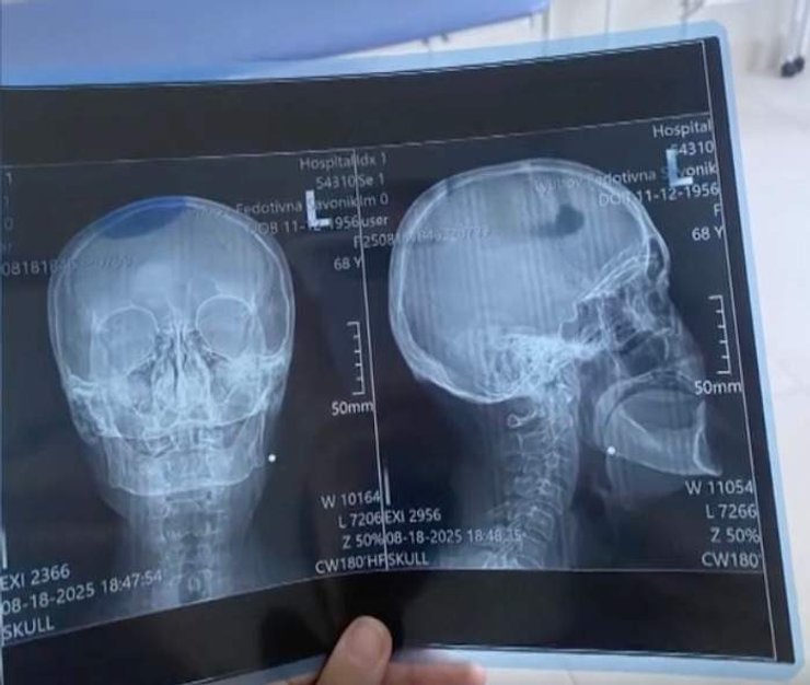 снимок щеки