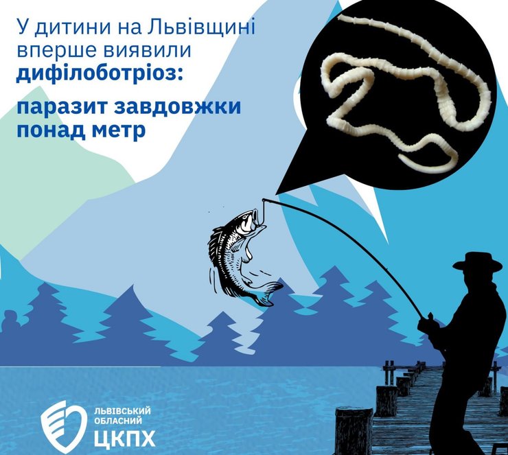 Во Львове впервые диагностировали дифилоботриоз у ребенка