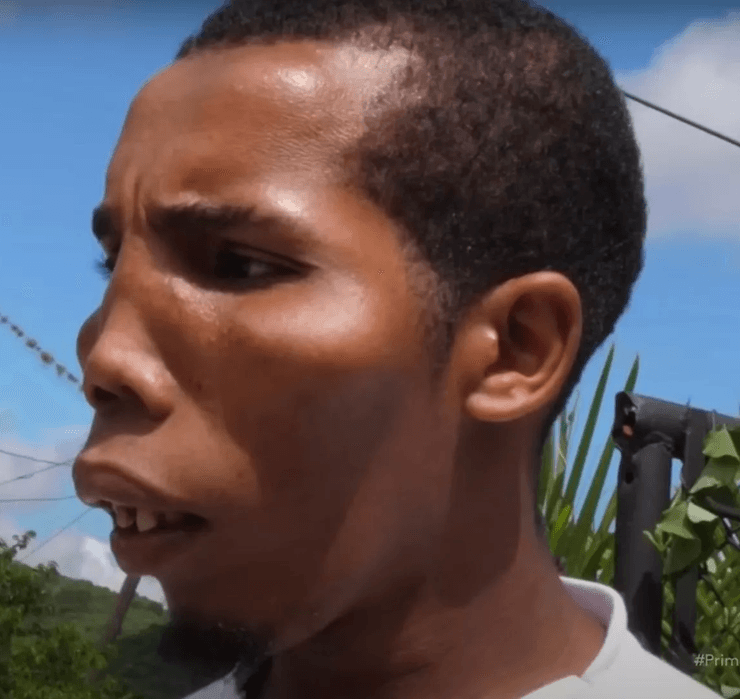 Семья, в которой дети болеет редким заболеванием, загадочные симптомы, редкая болезнь, деформация лица, проблемы со здоровьем