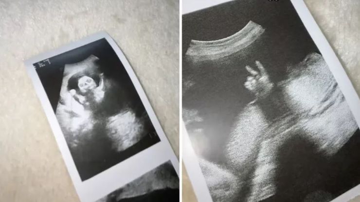 Мама не могла поверить своим глазам, когда увидела свою дочь во время УЗИ, что она увидела на мониторе