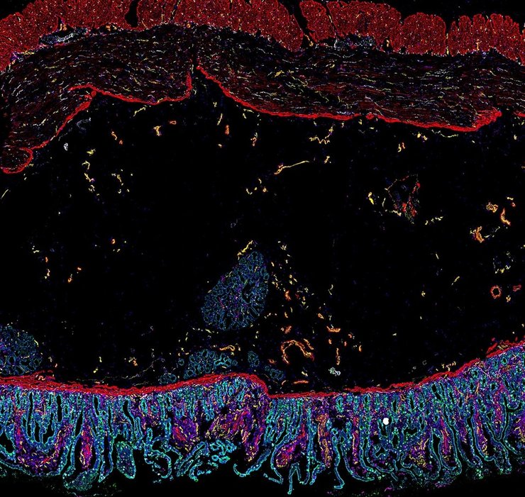 человеческий кишечник