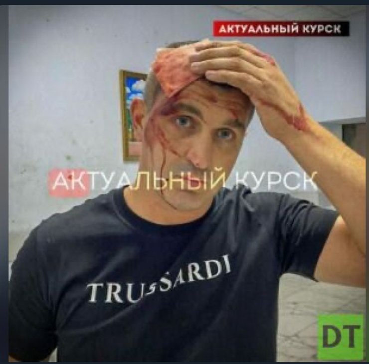 Російський депутат Микола Ішаков, Маріуполь, побиття