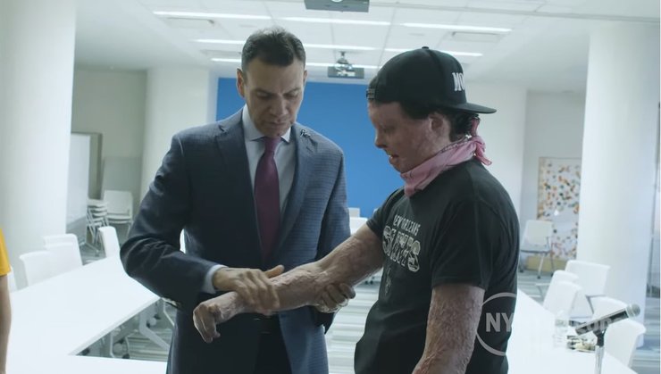 Джо Дімі, пацієнт, фото, операція, пересадка обличчя