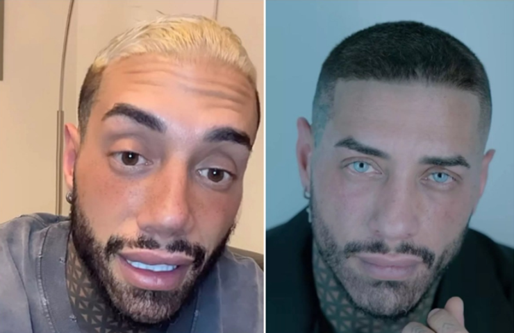 Звезда реалити-шоу Франческо Чиофало, изменение цвета глаз хирургическим способом, как увеличить рост, красота, внешность