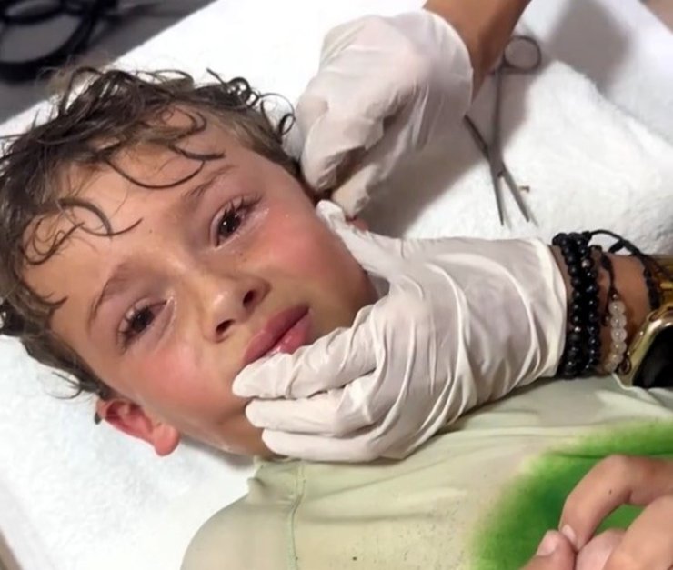 Врач в медицинских перчатках удаляет краба из уха испуганного мальчика в Мексике