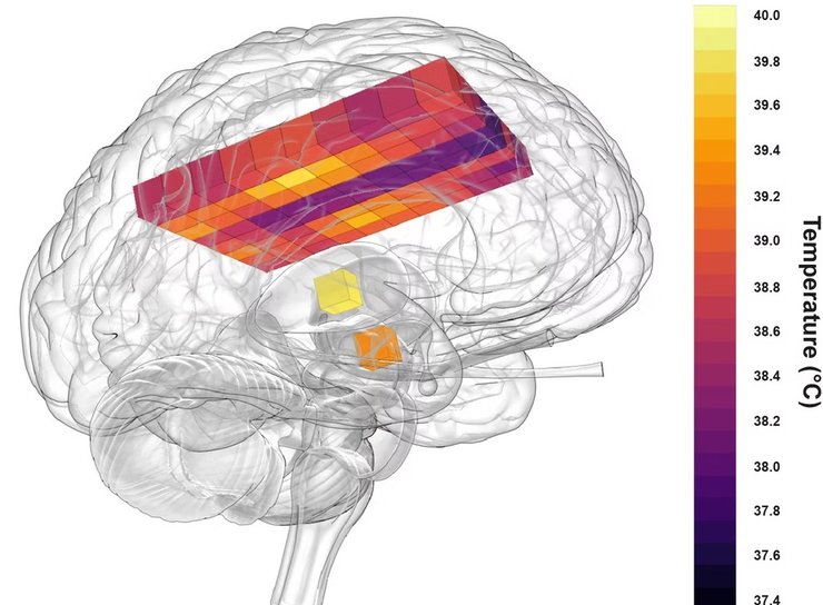 температура, мозг