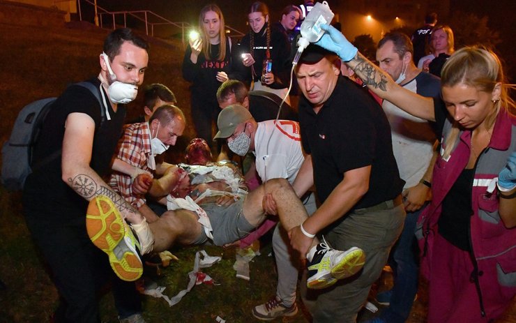 фото, Беларусь, протесты, раненый протестующий, протесты в Беларуси, выборы, 2020