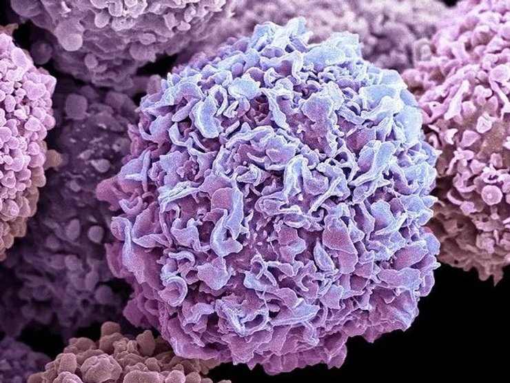 ракова клітка