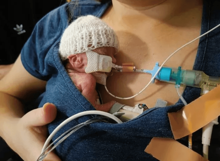 дитина, Уельс, Велика Британія, новонароджений, крихітна дитина, унікальний випадок