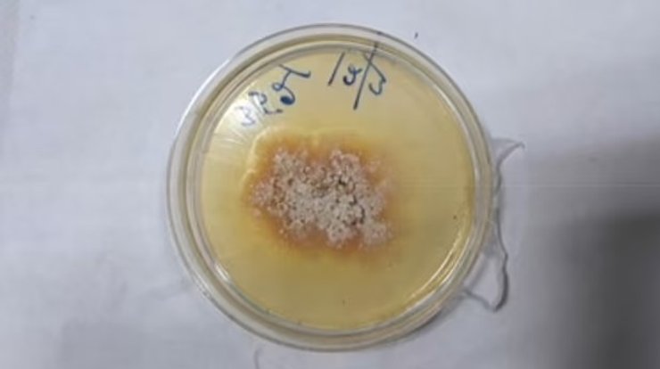 анализ образец гной