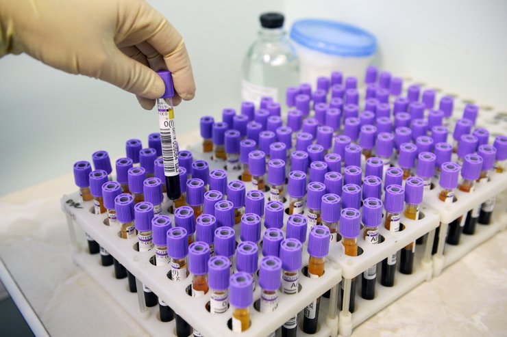 Жена оказалась сестрой, родственные отношения, ДНК-тест, курьезы, супруги, пересадка почки