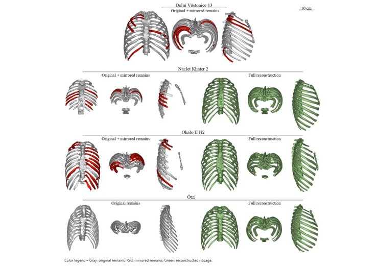 грудна клітка