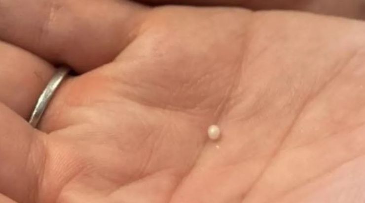 Сюрприз у страві в ресторані, чоловік знайшов справжню перлину в мідіях, знахідка, цікаві історії