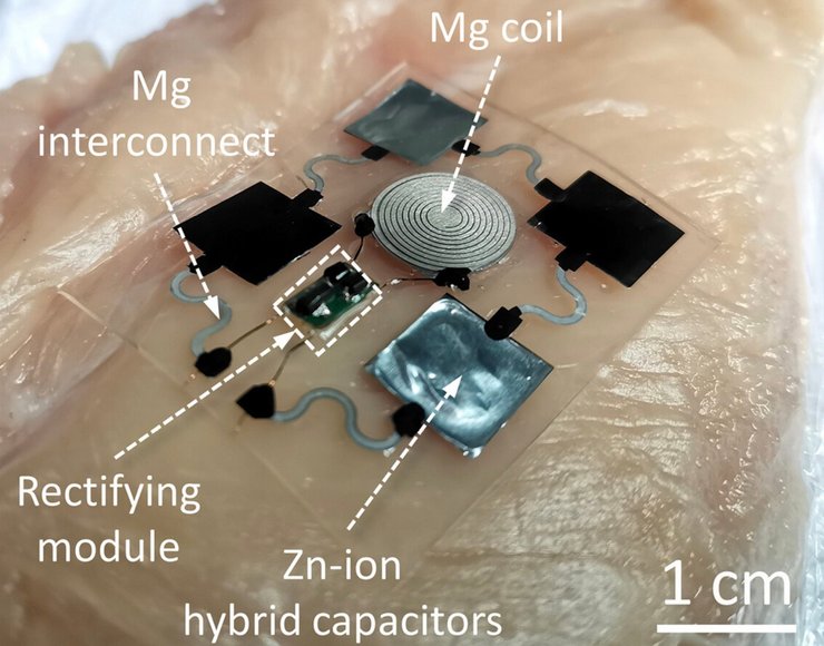 имплантат, биоинженерия