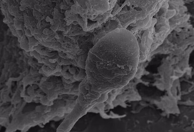 космос сперматозоиды